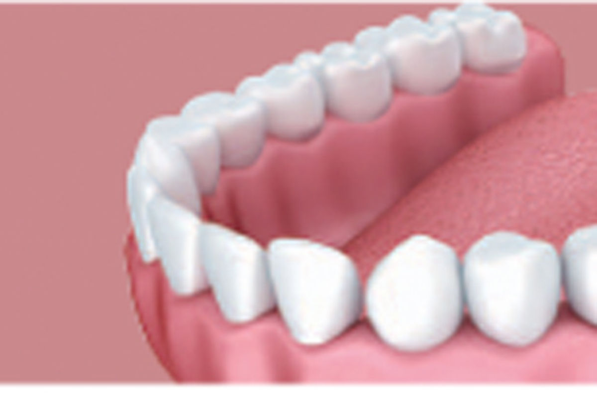 Customer Teeth MIND YOUR TEETH : Six dental procedures to help you smile confidently ...