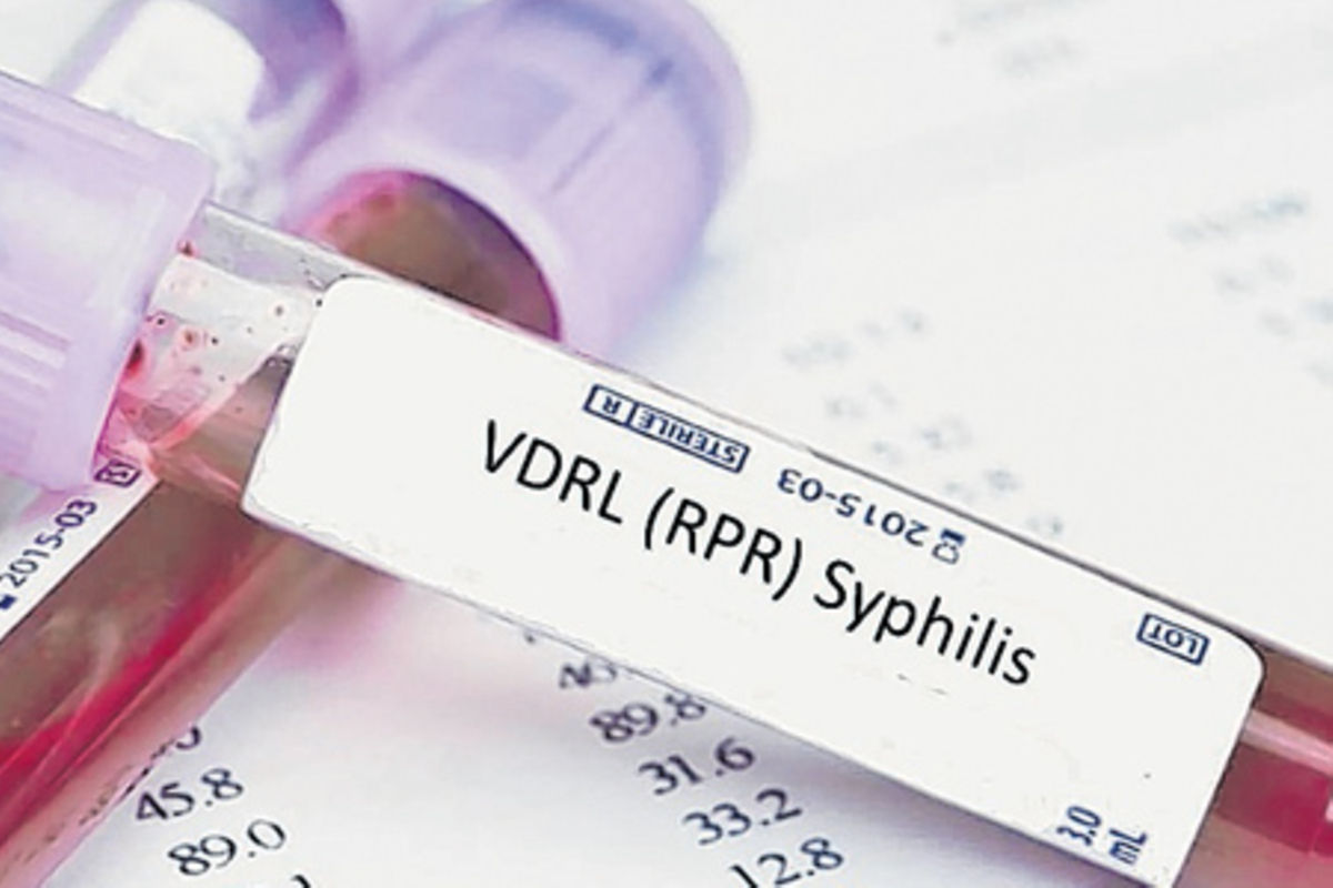 Can condom use still prevent syphilis? The Citizen