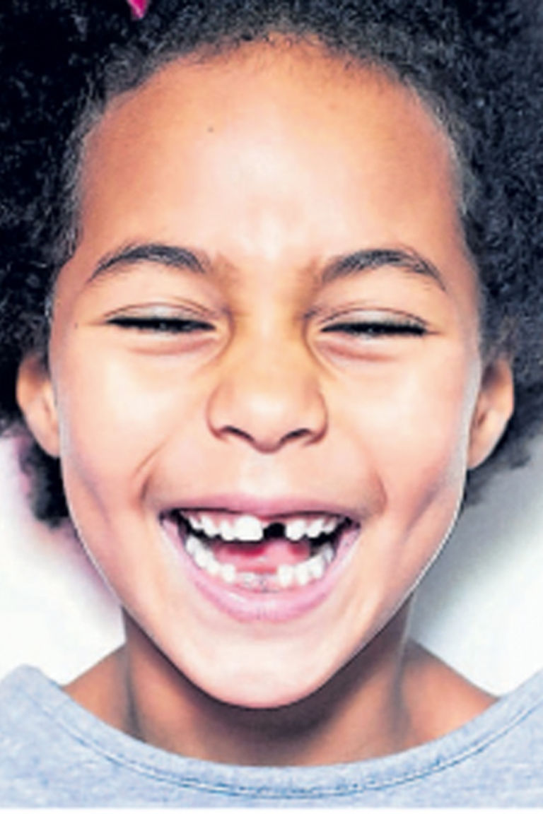 What happens if you don’t replace a missing tooth? The Citizen