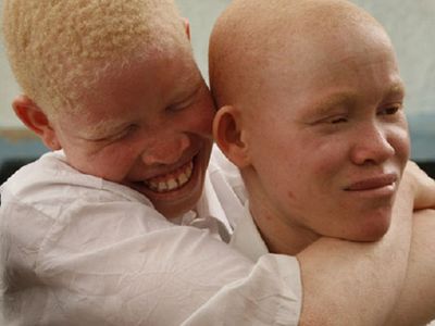 Do more to protect albinos, says body - The Citizen
