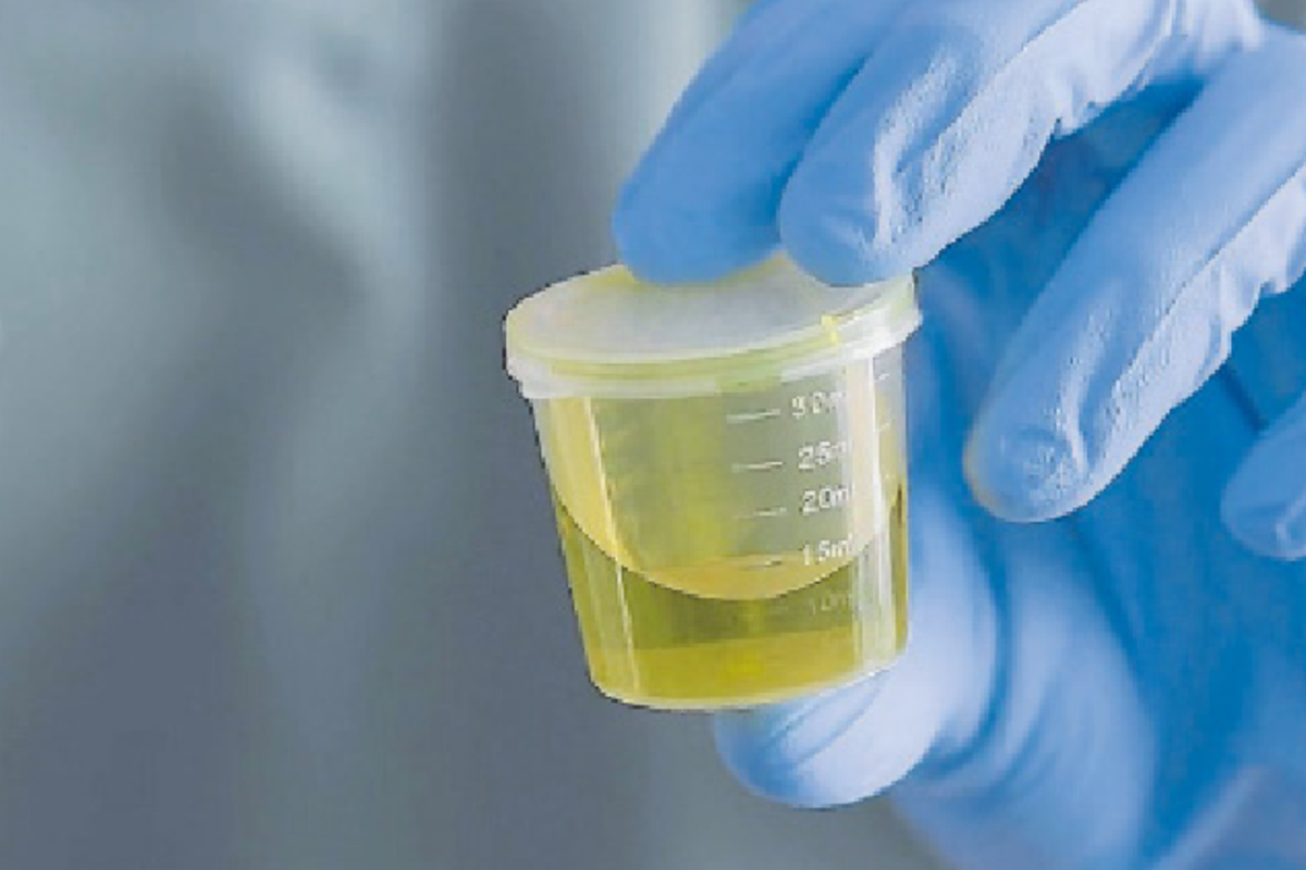 Why is my urine yellow? The Citizen