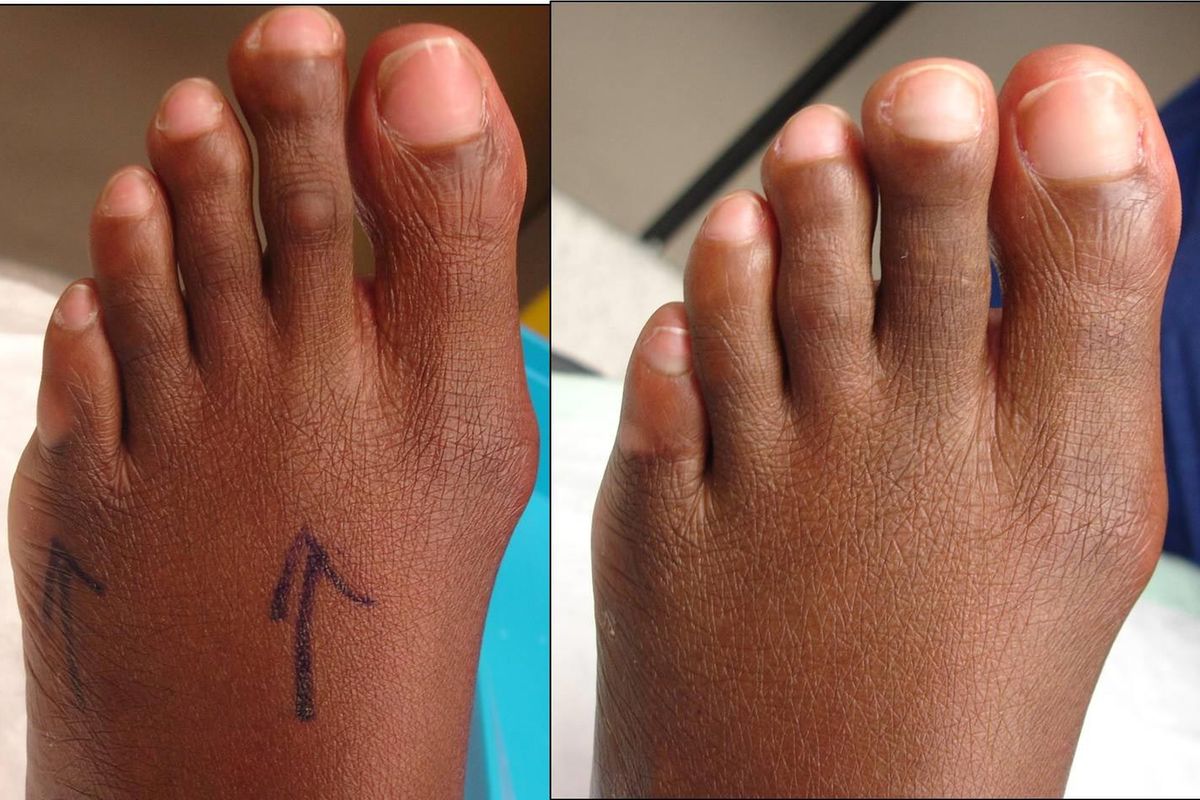 Doc, why do my feet ache? The Citizen