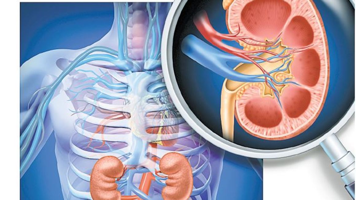 Nine reasons that can lead to kidney transplant failure The Citizen