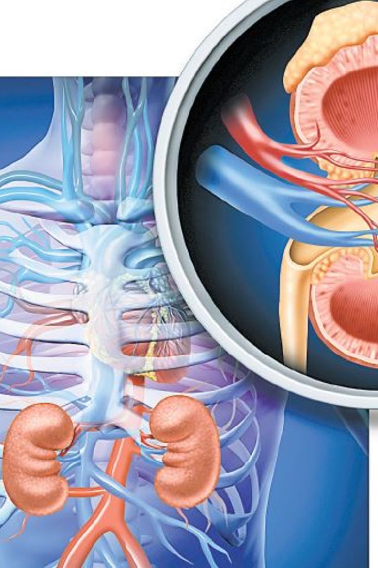 Nine Reasons That Can Lead To Kidney Transplant Failure The Citizen