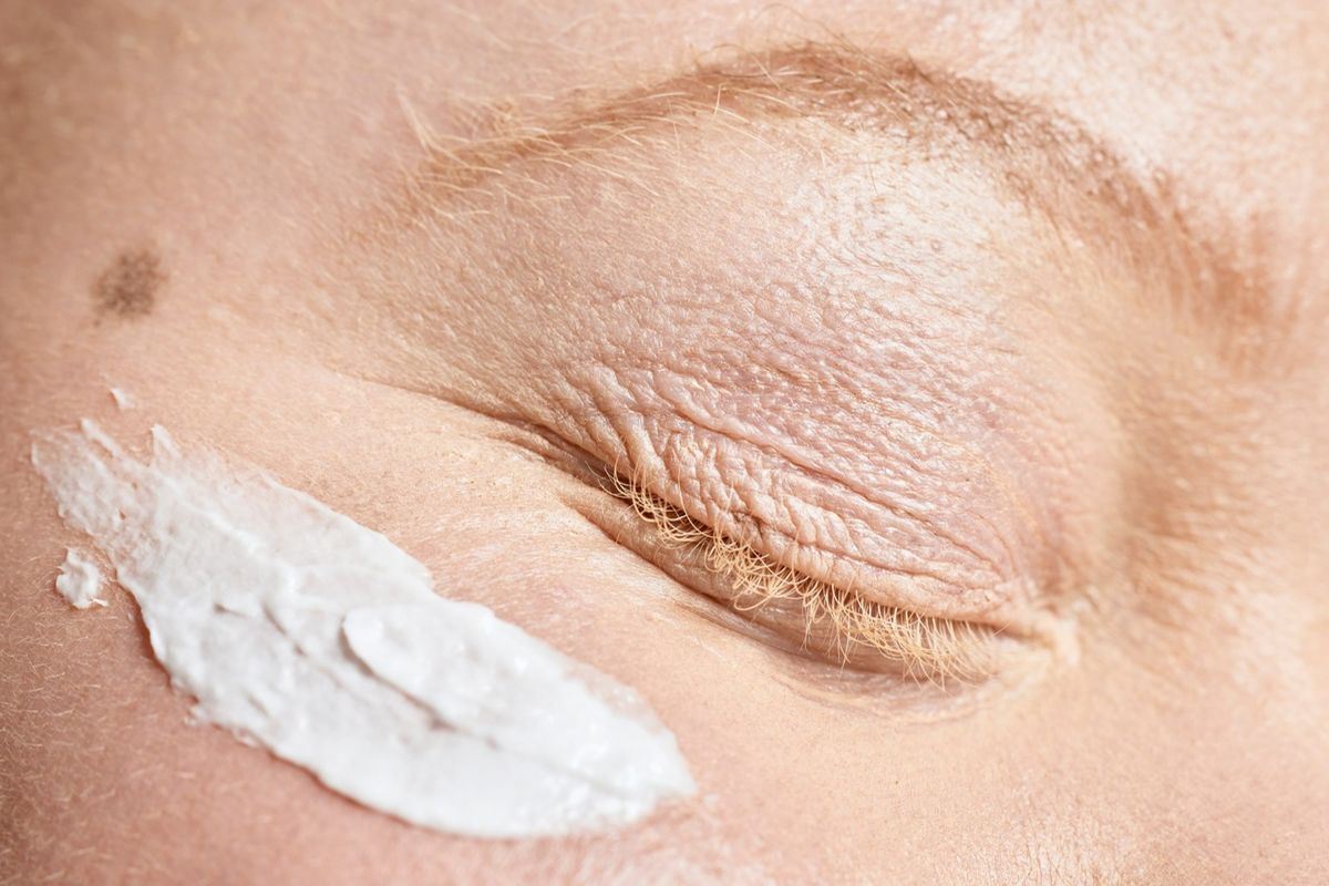 Sh1.9bn set aside for albinism skin oil as Tanzania tightens oversight