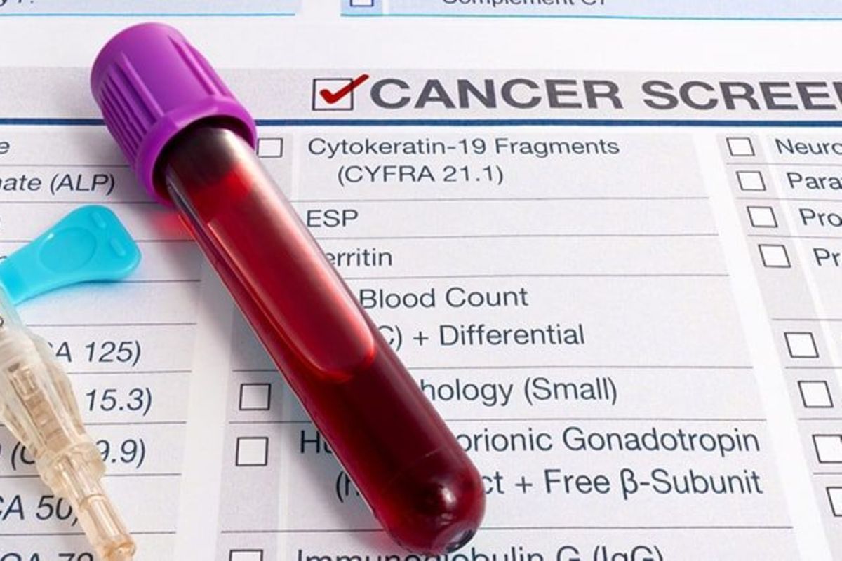 Tanzanians urged to seek early cancer screening