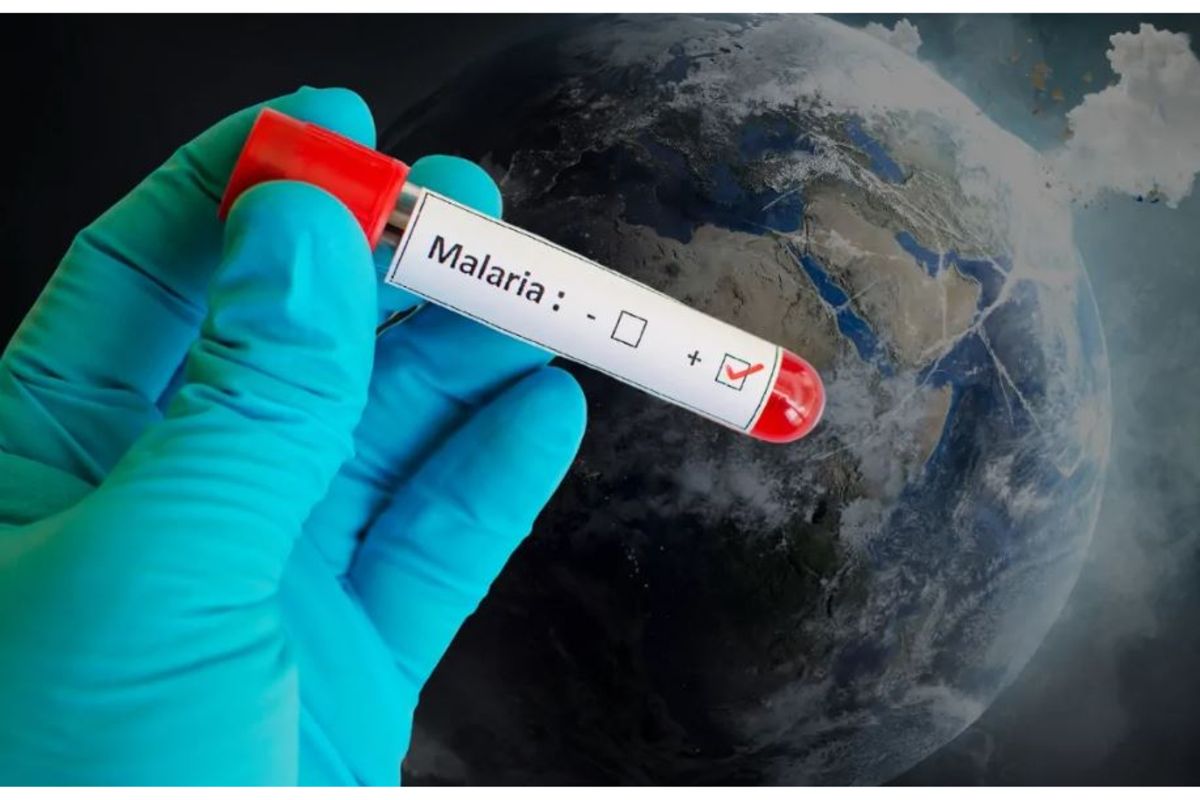 Climate change could add 123 million malaria cases in Africa by 2050, study warns