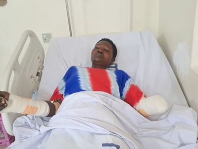 Mara woman loses palm in alleged ex-husband's machete attack